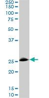 Anti-RNF141 Mouse Monoclonal Antibody [clone: 6D9]