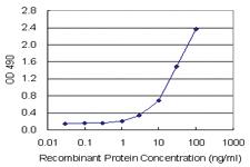 Anti-PEPD Antibody Pair