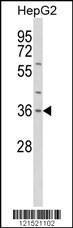 Anti-IL1A Rabbit Polyclonal Antibody (AP (Alkaline Phosphatase))