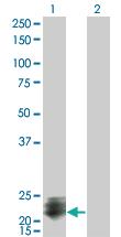 Anti-STMN2 Mouse Monoclonal Antibody [clone: 2G7]