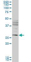 Anti-IFT57 Mouse Monoclonal Antibody [clone: 1G8]