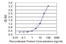 Anti-PEPD Polyclonal Antibody Pair