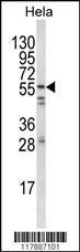 Anti-FYN Rabbit Polyclonal Antibody (APC (Allophycocyanin))