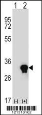 Anti-C1QTNF6 Rabbit Polyclonal Antibody