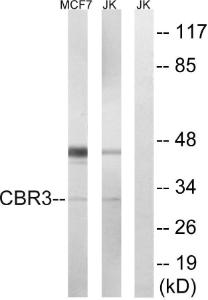 Western blot analysis of lysates from Jurkat and MCF7 cells using Anti-CBR3 Antibody. The right hand lane represents a negative control, where the Antibody is blocked by the immunising peptide