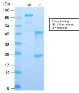 Antibody anti-CD34 HPCA12598R BSA 100 µg