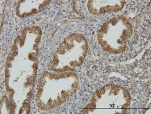 Anti-NDRG1 Mouse Monoclonal Antibody [clone: 2D7]