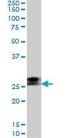 Anti-RNF141 Mouse Monoclonal Antibody [clone: 6D9]