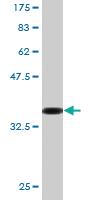 Anti-MTA1 Mouse Monoclonal Antibody [clone: 1C3]