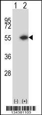 Anti-DTNBP1 Rabbit Polyclonal Antibody (HRP (Horseradish Peroxidase))