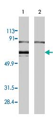 Anti-ER-alpha Rabbit Polyclonal Antibody