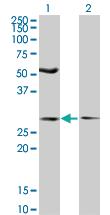 Anti-IFT57 Mouse Monoclonal Antibody [clone: 3G4]