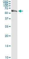 Anti-PEPD Polyclonal Antibody Pair