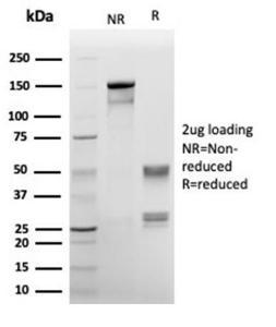 SDS-PAGE analysis of Anti-Annexin A1 Antibody [rANXA1/6451] under non-reduced and reduced conditions; showing intact IgG and intact heavy and light chains, respectively. SDS-PAGE analysis confirms the integrity and purity of the antibody