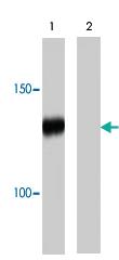 Anti-PHOT1 Rabbit Polyclonal Antibody