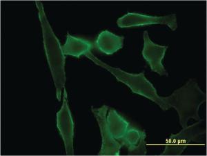 Anti-STMN2 Mouse Monoclonal Antibody [clone: 1A7]