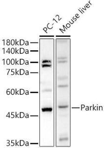 Western blot analysis of extracts of various cell lines, using Anti-Parkin Antibody (A12727) at 1:500 dilution. The secondary antibody was Goat Anti-Rabbit IgG H&L Antibody (HRP) at 1:10,000 dilution.