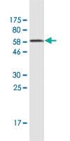 Anti-EPAS1 Mouse Monoclonal Antibody [clone: 1G2]