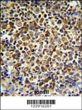 Anti-KIR2DL5B Rabbit Polyclonal Antibody (AP (Alkaline Phosphatase))