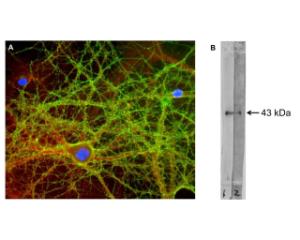 A: Immunofluorescence analysis of GAP43 expression (green) in mixed neuron-glial cµltures with C-1649-100. <br />B: Western blot of cow hippocampus extract. C-1649-100 detects GAP43 at its expected molecµlar weight of ~43 kDa.