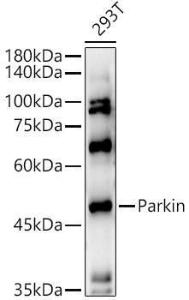 Western blot analysis of extracts of 293T cells, using Anti-Parkin Antibody (A12727) at 1:500 dilution. The secondary antibody was Goat Anti-Rabbit IgG H&L Antibody (HRP) at 1:10,000 dilution.