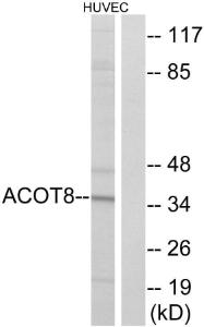 Western blot analysis of lysates from HUVEC cells using Anti-ACOT8 Antibody. The right hand lane represents a negative control, where the Antibody is blocked by the immunising peptide