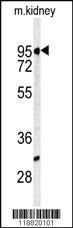 Anti-MME Rabbit Polyclonal Antibody