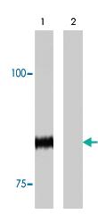 Anti-PHOT1 Rabbit Polyclonal Antibody