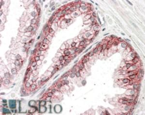 EB07242 (3.8 µg/ml) staining of paraffin embedded Human Prostate. Steamed antigen retrieval with citrate buffer pH 6, AP-staining.