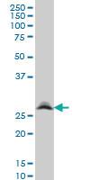 Anti-RNF141 Mouse Monoclonal Antibody [clone: 6D9]