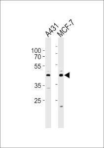 Anti-IDH3G Rabbit Polyclonal Antibody