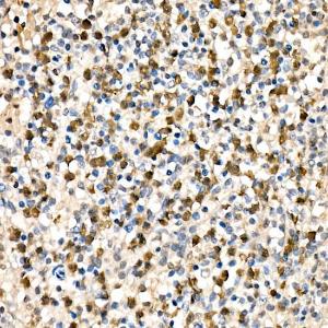 Immunohistochemistry analysis of paraffin-embedded human spleen using Anti-Parkin Antibody (A12727) at a dilution of 1:200 (40x lens). Perform high pressure antigen retrieval with 10 mM citrate buffer pH 6.0 before commencing with IHC staining protocol.