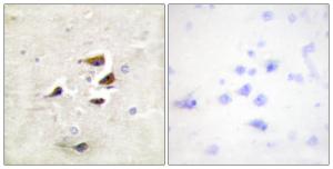 Immunohistochemical analysis of paraffin-embedded human brain tissue using Anti-CaMK2 alpha + beta + delta Antibody. The right hand panel represents a negative control, where the antibody was pre-incubated with the immunising peptide