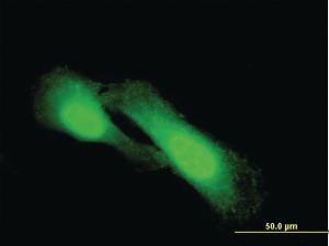 Anti-NDRG1 Mouse Monoclonal Antibody [clone: 2D7]