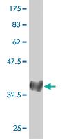 Anti-NEUROG1 Mouse Monoclonal Antibody [clone: 1F10]