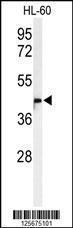 Anti-M11D1 Rabbit Polyclonal Antibody (FITC (Fluorescein Isothiocyanate))