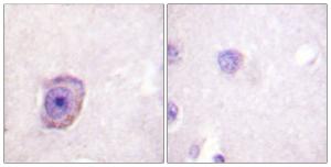 Immunohistochemical analysis of paraffin-embedded human brain using Anti-Rhodopsin (phospho Ser334) Antibody. The right hand panel represents a negative control, where the antibody was pre-incubated with the immunising peptide