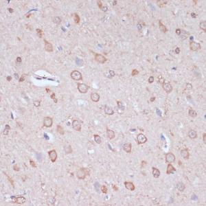 Immunohistochemistry analysis of paraffin-embedded rat brain using Anti-CART Antibody (A305732) at a dilution of 1:100 (40X lens). Perform microwave antigen retrieval with 10 mM PBS buffer pH 7.2 before commencing with IHC staining protocol