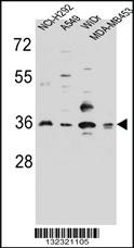 Anti-RIC3 Rabbit Polyclonal Antibody