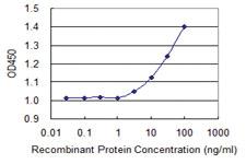 Anti-STMN2 Mouse Monoclonal Antibody [clone: 1A7]