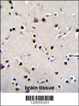 Anti-LRRC46 Rabbit Polyclonal Antibody (FITC (Fluorescein Isothiocyanate))