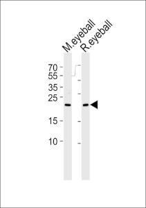 Anti-RCVRN Rabbit Polyclonal Antibody