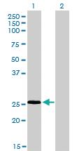 Anti-RNF141 Mouse Monoclonal Antibody [clone: 6D9]