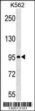 Anti-ABI3BP Rabbit Polyclonal Antibody (PE (Phycoerythrin))