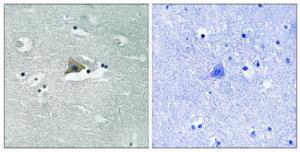 Immunohistochemical analysis of paraffin-embedded human brain using Anti-Claudin 5 (phospho Tyr217) Antibody. The right hand panel represents a negative control, where the antibody was pre-incubated with the immunising peptide.