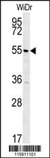 Anti-GK Rabbit Polyclonal Antibody