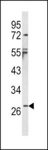 Anti-IL1B Rabbit Polyclonal Antibody (HRP (Horseradish Peroxidase))