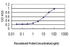 Anti-NDRG1 Mouse Monoclonal Antibody [clone: 2D7]