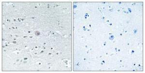 Immunohistochemical analysis of paraffin-embedded human brain using Anti-ARSF Antibody 1:100 (4°C overnight). The right hand panel represents a negative control, where the antibody was pre-incubated with the immunising peptide.