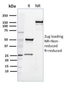 SDS-PAGE analysis of Anti-CD36 Antibody [185-1G2] under non-reduced and reduced conditions; showing intact IgG and intact heavy and light chains, respectively SDS-PAGE analysis confirms the integrity and purity of the antibody